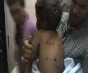 A child injured in Houla